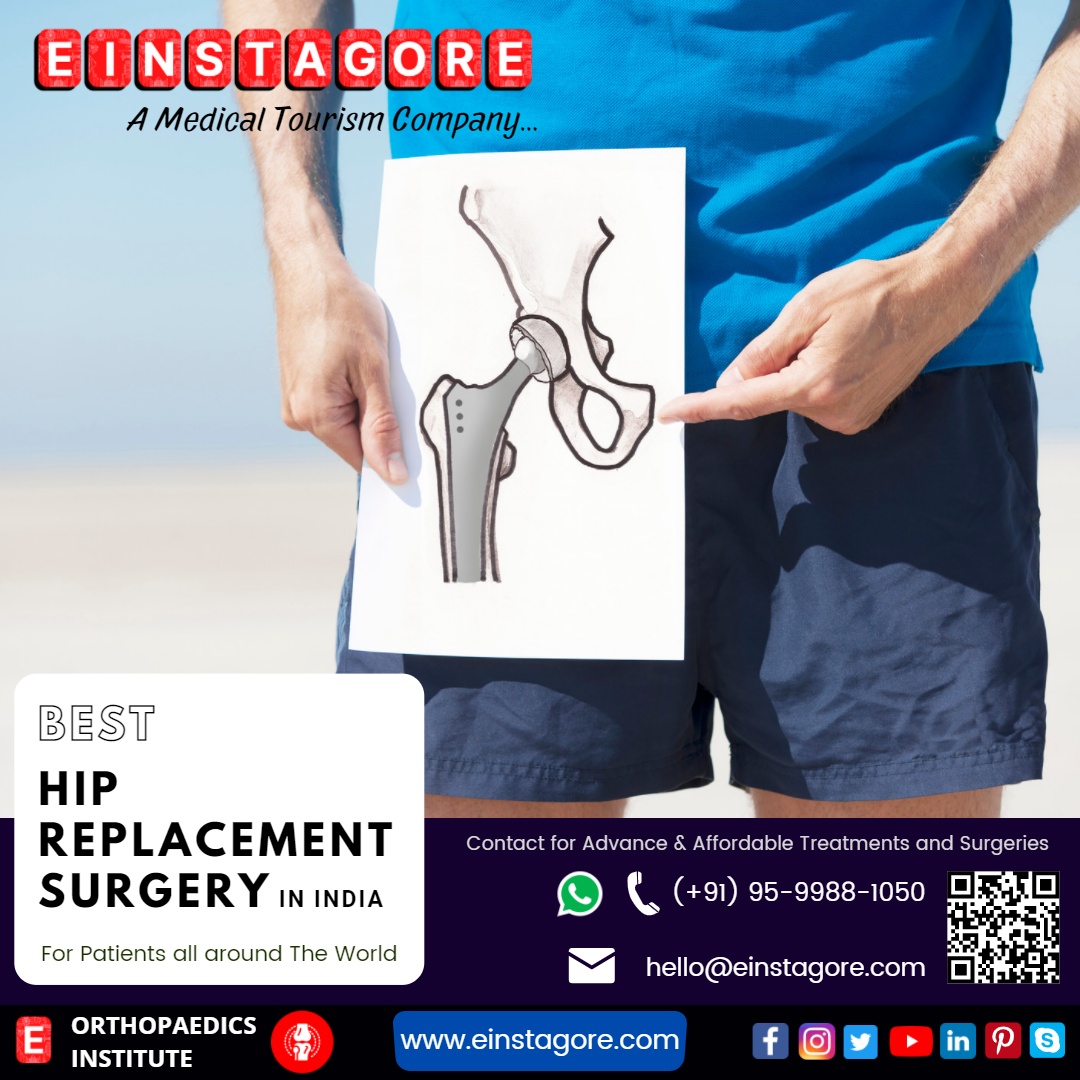 best hip replacement surgery in India